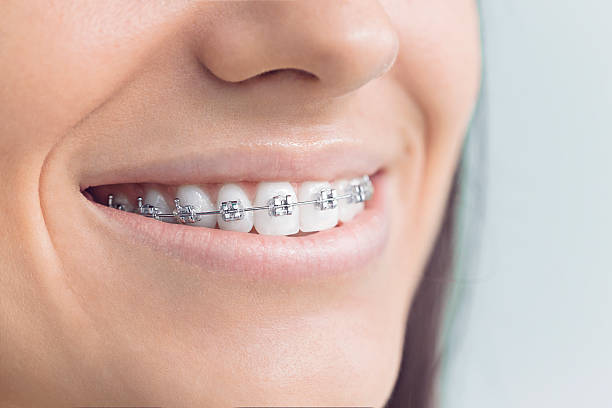 Why Choose Us for Your Dental Needs in Hudson Lake, IN